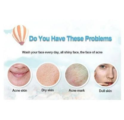 Bioaqua Acne Removal Cream Spot-Free Skin